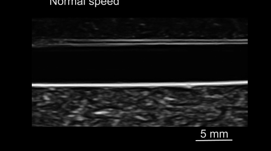 一场属于机器鱼的“奇幻漂流”，可在细小血管中“逆流而上”！(图12)